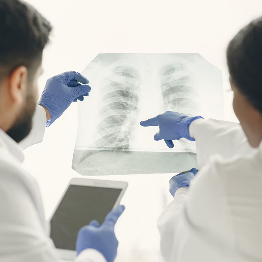 Tuberculosis (TB) specialist Alappuzha